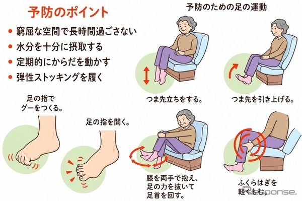 エコノミークラス症候群予防のポイント