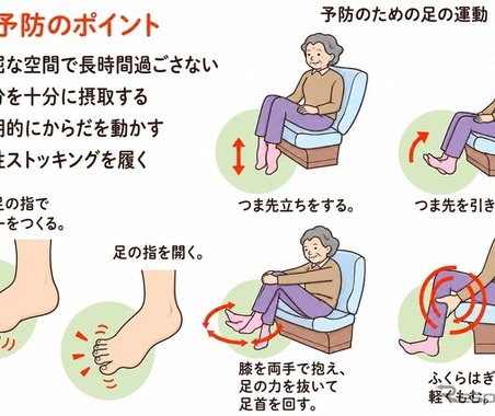 ＜注意喚起＞車中泊のエコノミークラス症候群、日本赤十字社が対策を紹介…熊本地震 画像